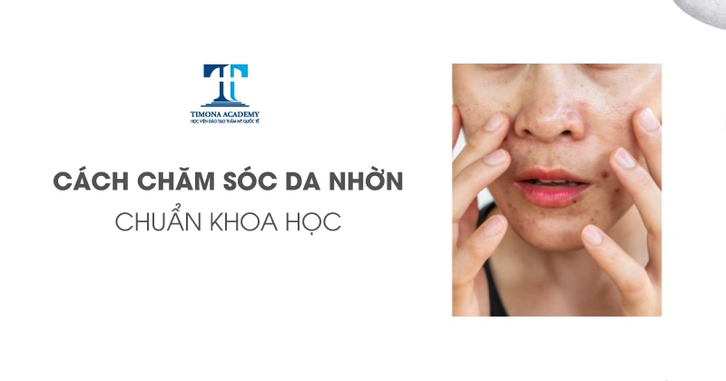 Chăm sóc da nhờn hiệu quả