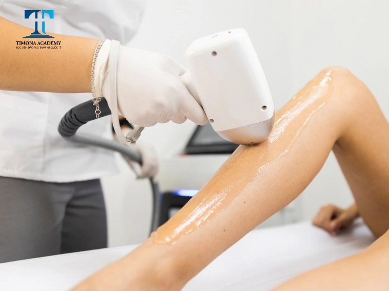 Mỗi loại công nghệ có ưu điểm riêng