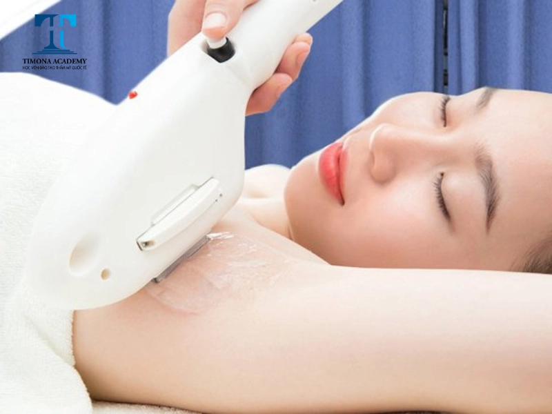 Triệt lông nách là dịch vụ không thể không nhắc tới