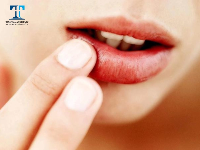 Môi bị sưng sau phun xăm là hiện tượng phổ biến