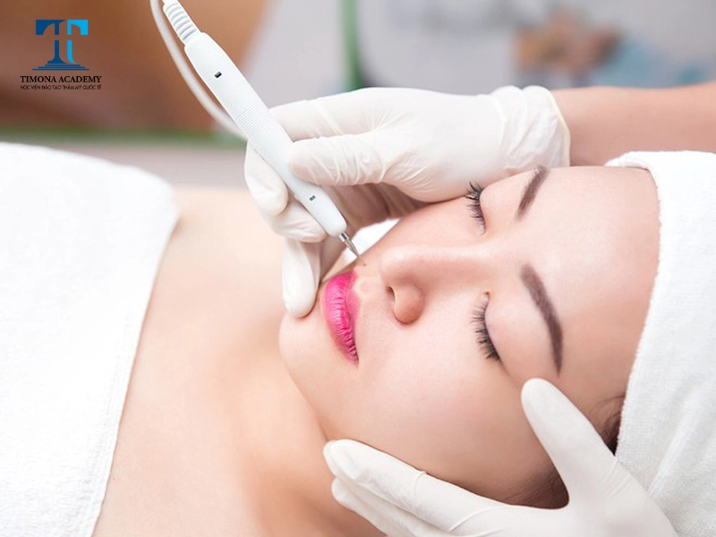 máy giúp loại bỏ nốt ruồi dễ dàng