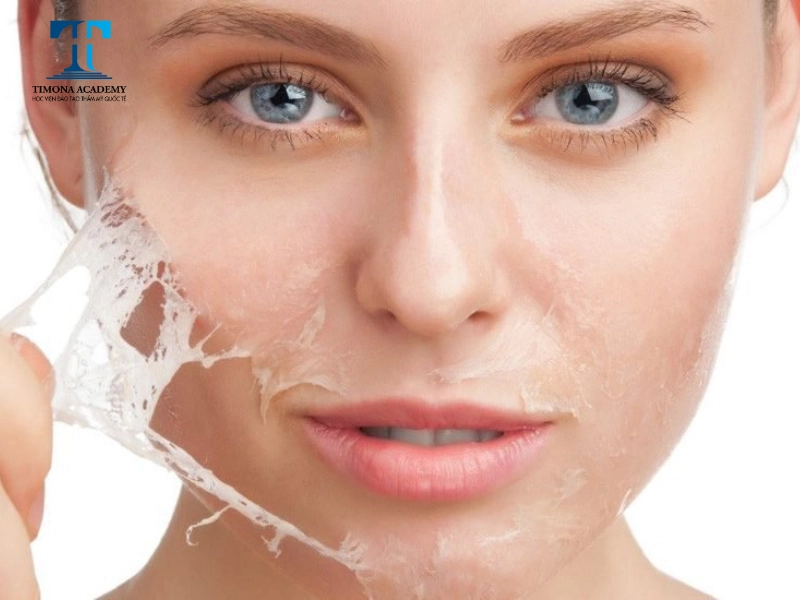 Peel da mang lại vô vàn lợi ích