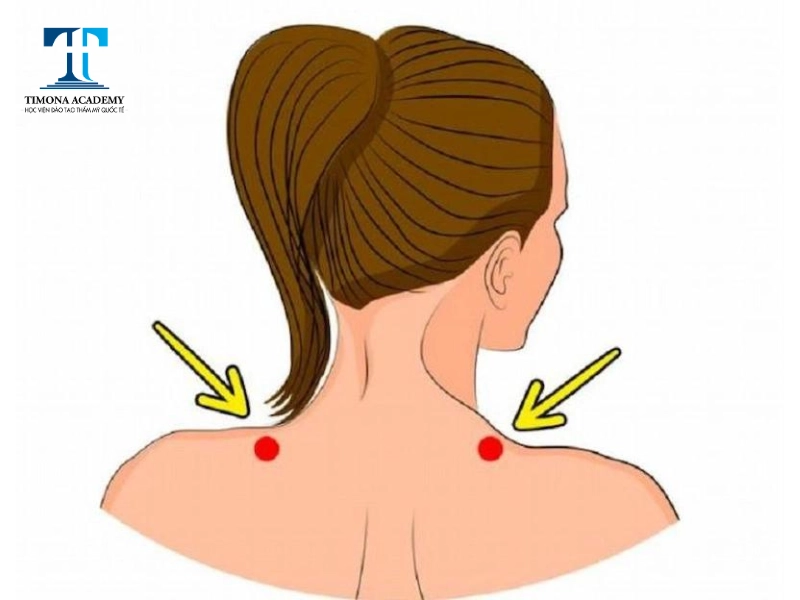 Chữa đau đầu bằng cách ấn huyệt kiên tỉnh ở phần mép vai