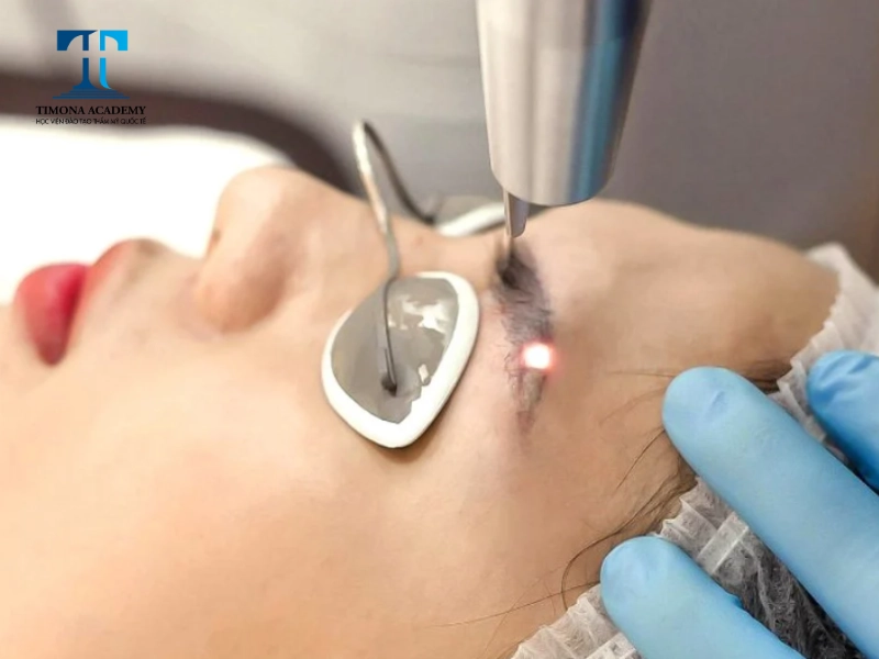 Quy trình thực hiện diễn ra vô cùng nhanh chóng