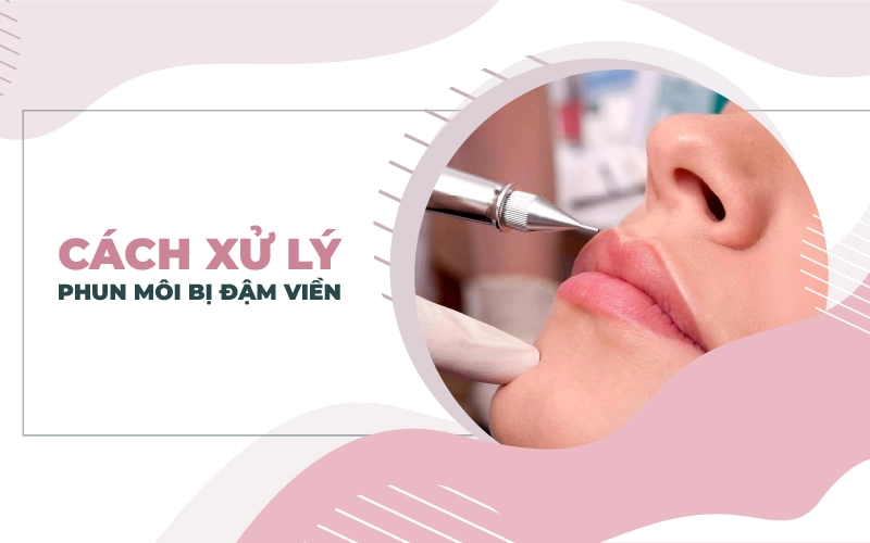 Xăm môi bị đậm ở viền