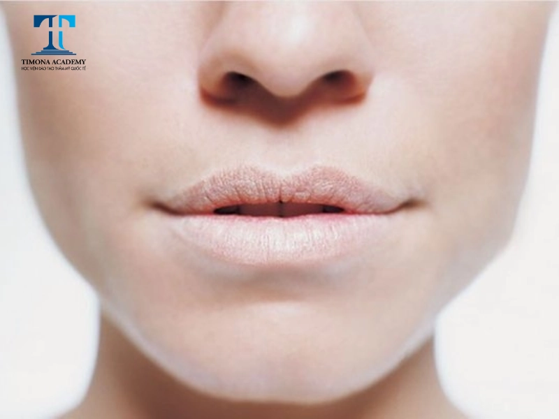 Kỹ thuật phun môi lỗi thời có thể ảnh hưởng đến môi