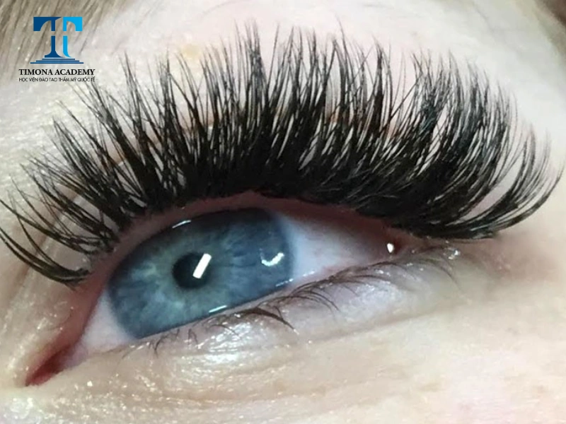 Kiểu mi nối Volume là kỹ thuật đơn giản có thể làm tại nhà
