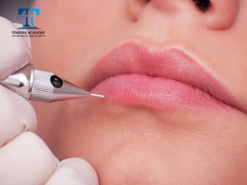 phun lại môi trong một số trường hợp