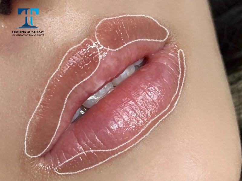 Tia tử ngoại là yếu tố hàng đầu làm cho viền môi thâm sạm