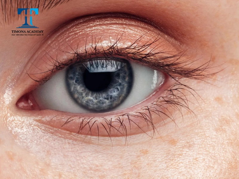 Kỹ thuật uốn mi tệ có thể khiến mắt bị tổn thương