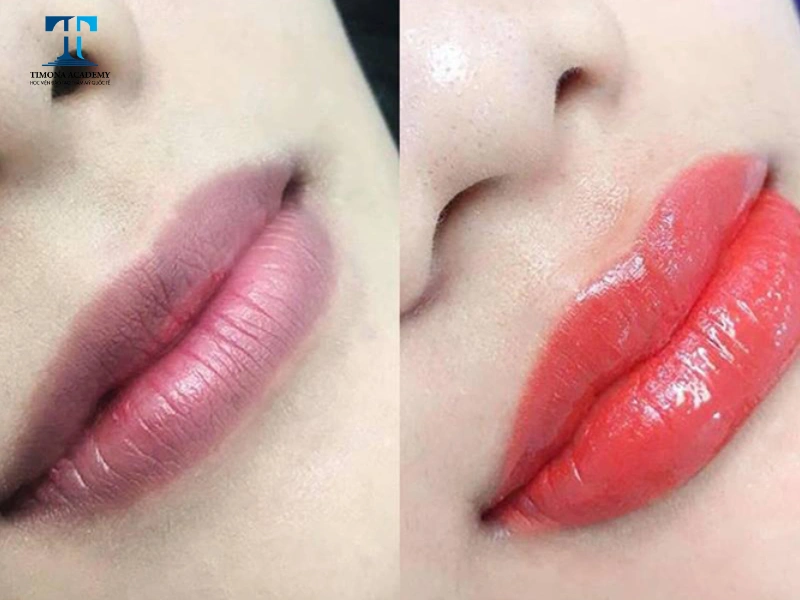Màu đỏ hồng giúp che đi vết thâm