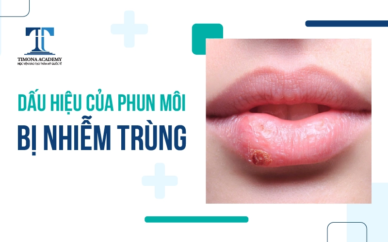 cách xử lý khi xăm môi bị nhiễm trùng