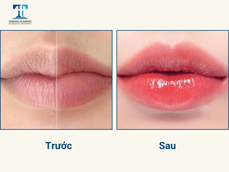 Hình ảnh trước và sau khi phun môi màu hồng đào collagen