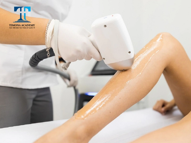 Công nghệ Diode Laser triệt lông cực kỳ hiệu quả