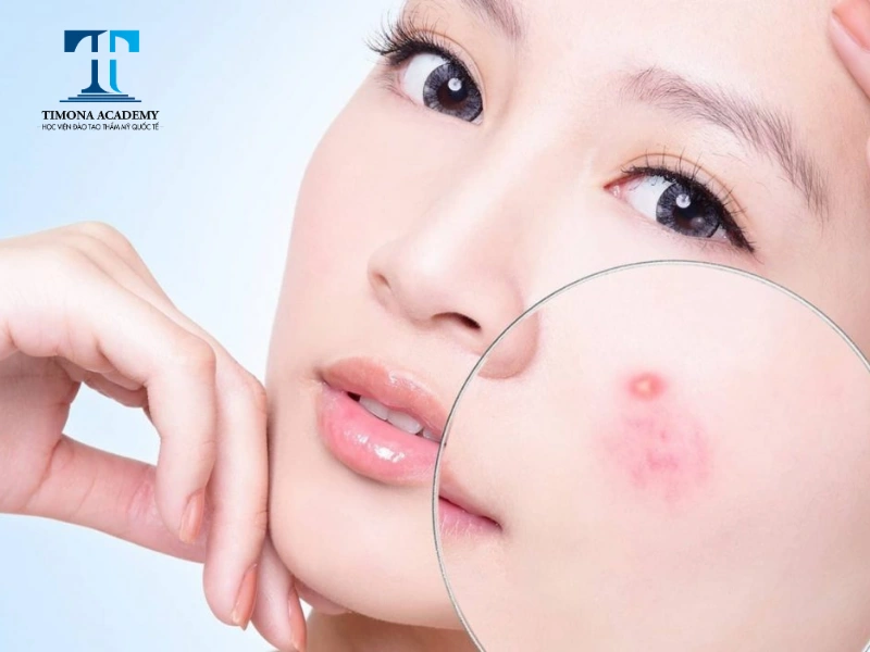 Không nên massage mặt quá mạnh tránh gây ức chế cho da