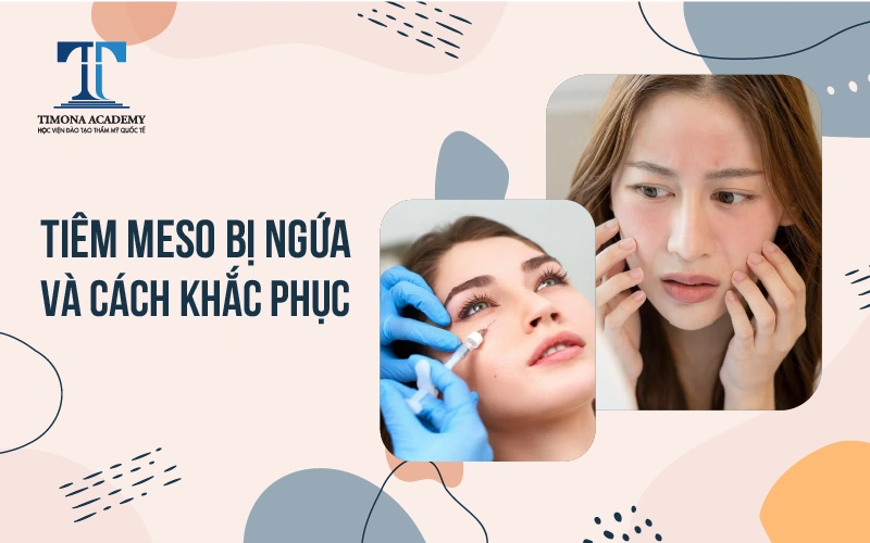 Tiêm meso xong bị ngứa