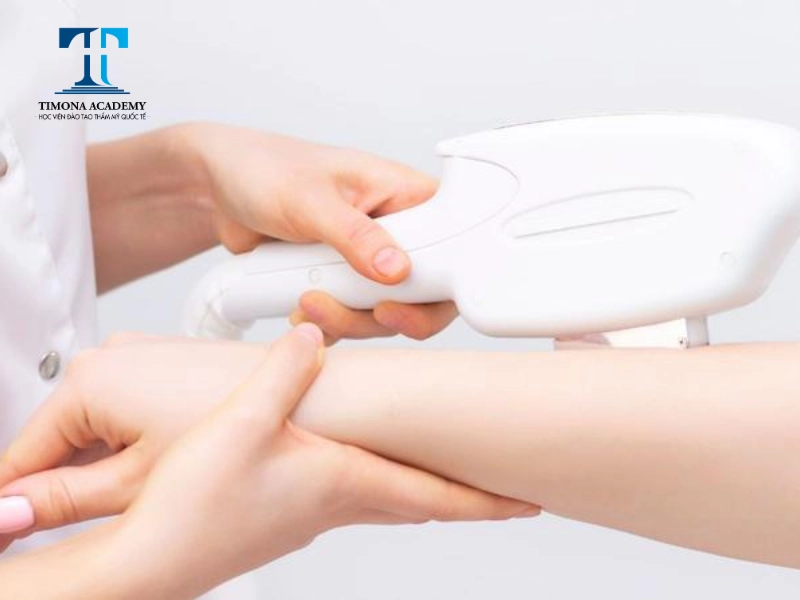 triệt lông lạnh đang được ưa chuộng tại các cơ sở thẩm mỹ