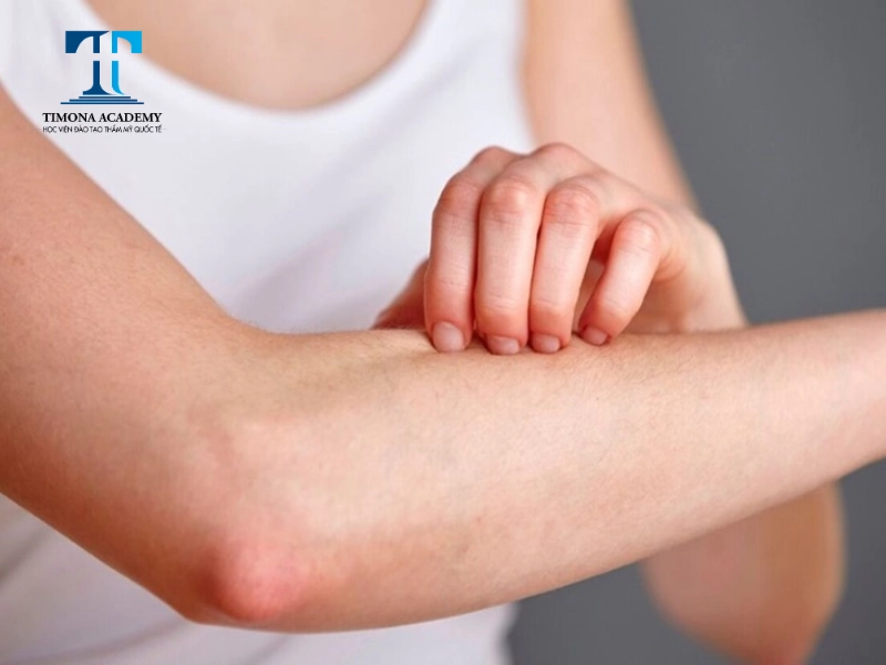 Người mắc bệnh lý về da thì không nên sử dụng công nghệ triệt lông lạnh