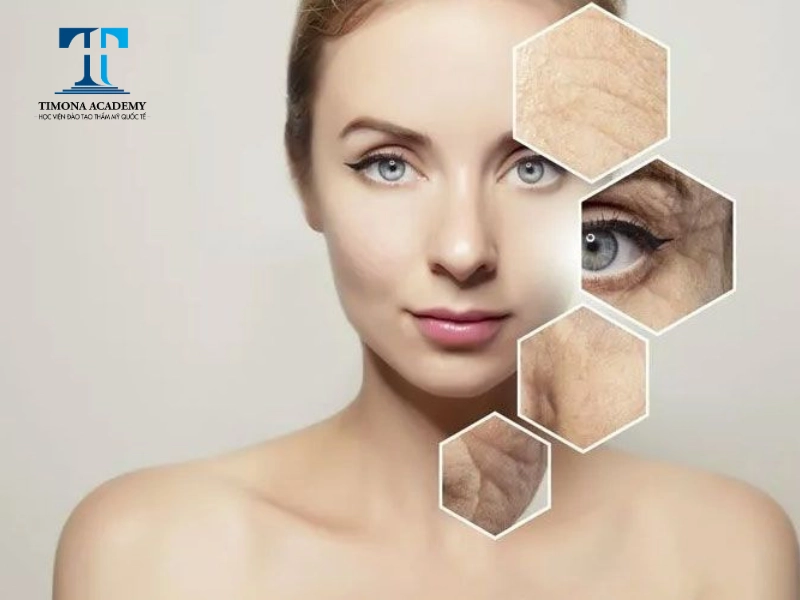 Công nghệ Ultherapy có hiệu quả cho vùng da nhiều nếp nhăn