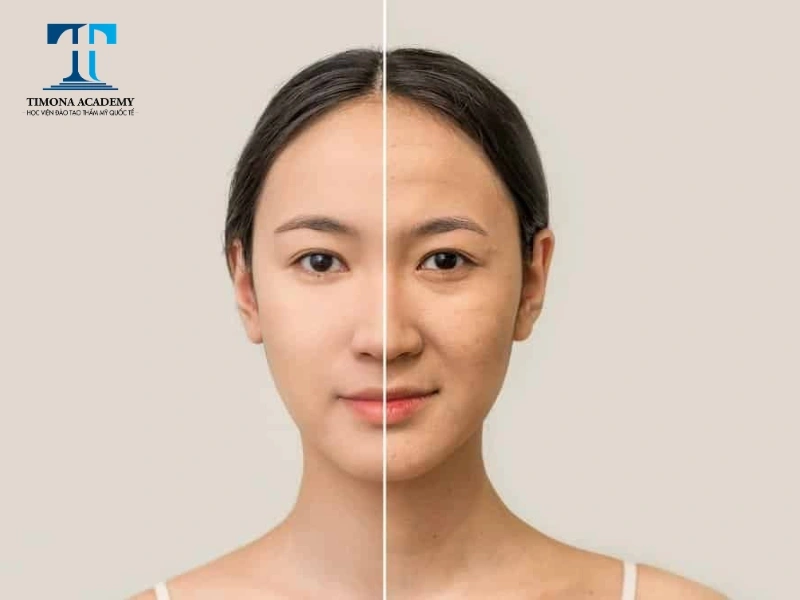 Chăm sóc da lão hóa cần kiêng trì để đạt được hiệu quả tối ưu