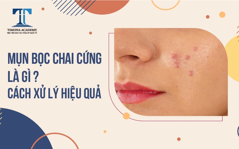 cách xử lý mụn bọc bị chai