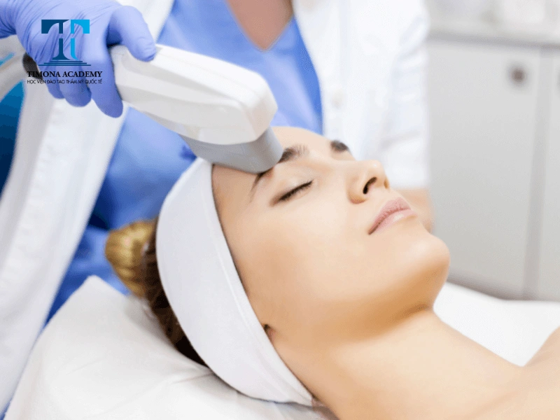 Công nghệ IPL giúp trị nám