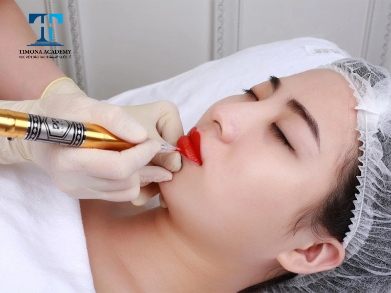 Các trường hợp cơ địa đặc biệt KTV cần đi kim nhẹ tay