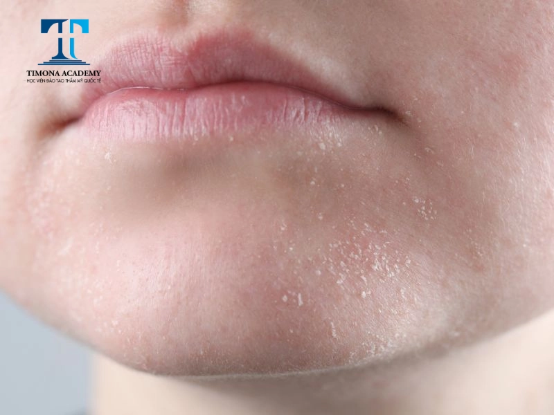 Đối tượng thải độc chì da mặt