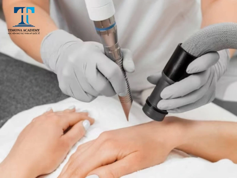 Công nghệ Thermage giúp trẻ hóa da tay hiệu quả