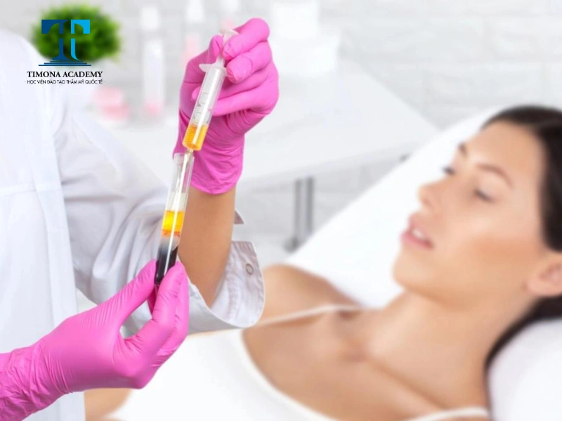 Kỹ thuật điều trị mụn PRP sẽ có trong chương trình đào tạo