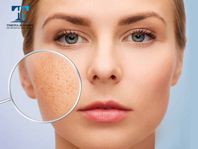Skincare đúng cách giúp cải thiện tình trạng lỗ chân lông to