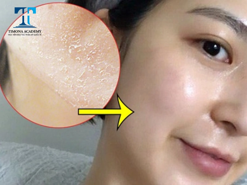 Trong quy trình skincare cho da khô, rửa mặt là bước giúp làm sạch da sâu hơn