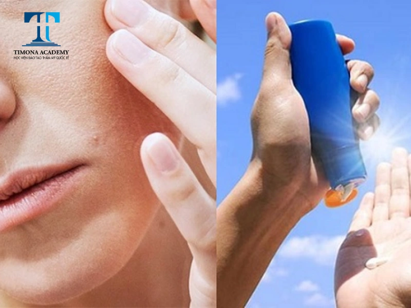 Bôi kem chống nắng là bước không thể thiếu khi skincare cho da khô