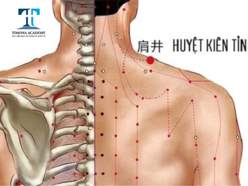Huyệt Kiên Tỉnh trị cảm giác đau vai gáy hiệu quả