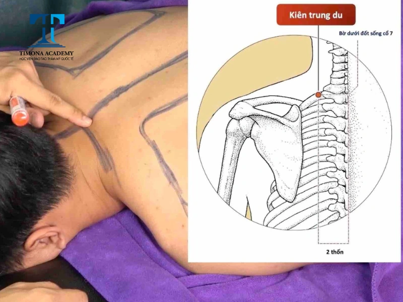Huyệt Kiên Trung Du nằm giữa bả vai